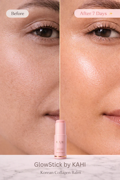 Before and after comparison of a woman's eye area with a product labeled 'GlowStick by kahi.